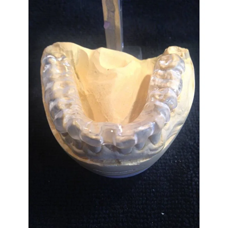 Vsmile 98mm Clear PMMA for partial denture framwork compatible open milling machine system