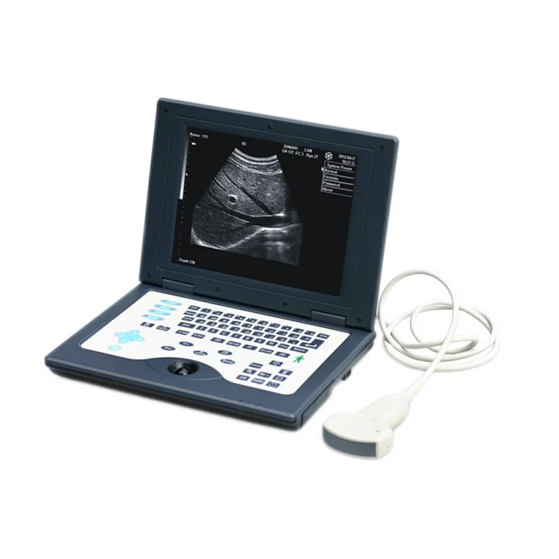 LTS5800 pseudo color 10.4inch Laptop ultrasound imaging system