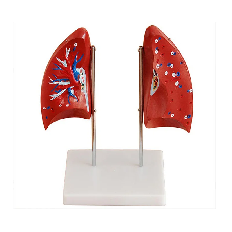 LTM321 Plastic anatomical Lung Model for sale