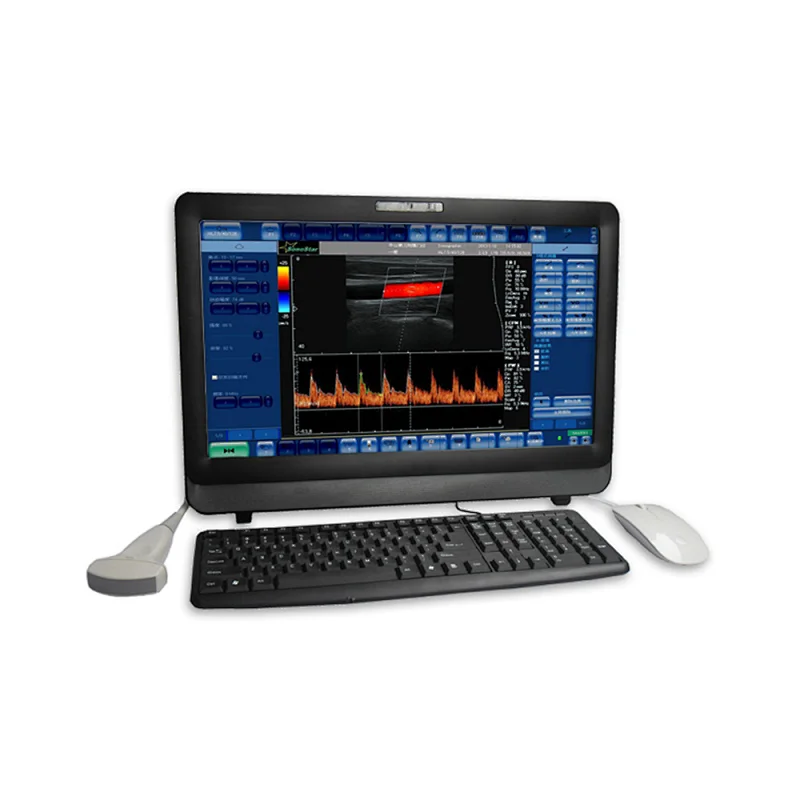 LTUB05 22'' large touch screen ultrasound machine color doppler