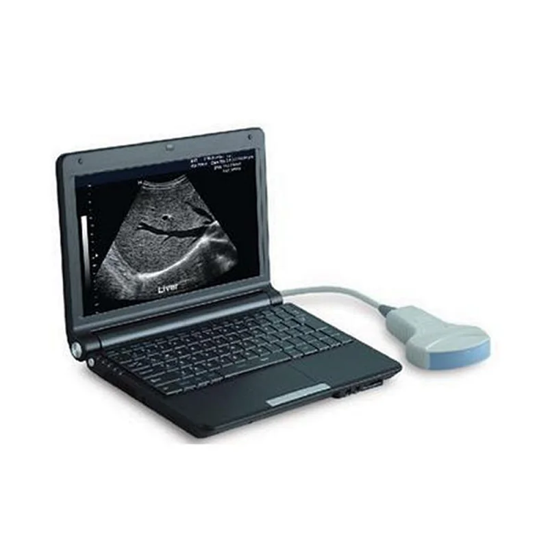 LTUB25 cheapest medical laptop ultrasound device
