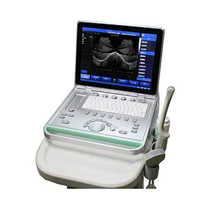 LTUB19 ARM based 15 inch high definition LED screen laptop ultrasound machine