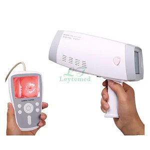 LTEC01 hot selling clinic Handheld portable Video Colposcope