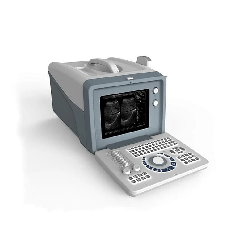 LTS-5Plus Cheapest portable ultrasound machine