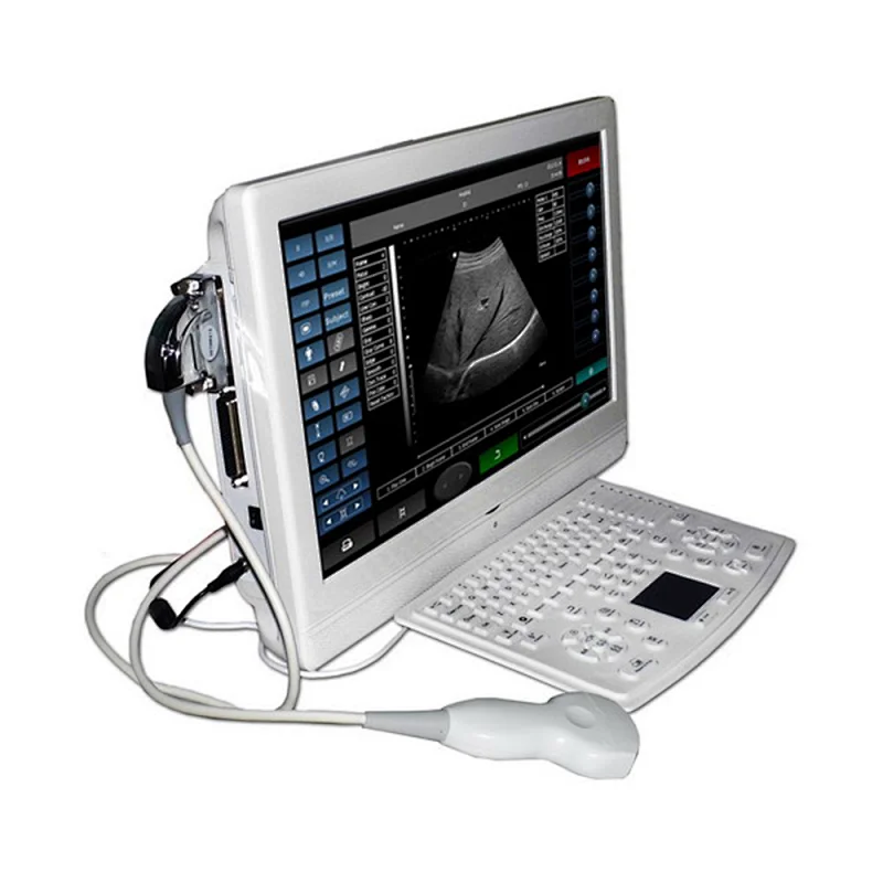 LTU-8 Touch Screen LCD Ultrasound Scanner for hospital price