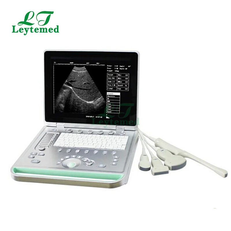 LTUB18 Cheap portable laptop ultrasound scanner