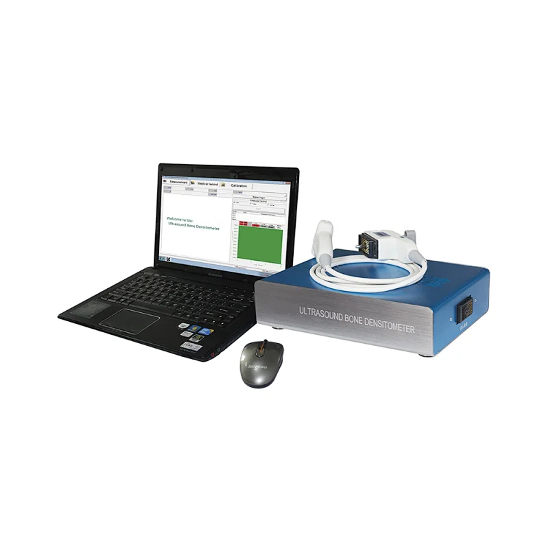LTUD01 Automatic High Effective Ultrasound Bone Densitometer