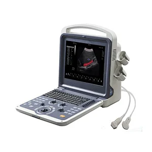 LTUB03 cheapest portable full digital cardiac color doppler ultrasound