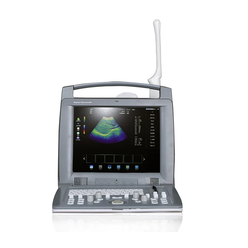 LT6018P Portable Color Full 3d digital ultrasound scanner