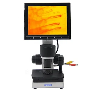 LCD Noninvasive Nail Microcirculation Checking Microscope