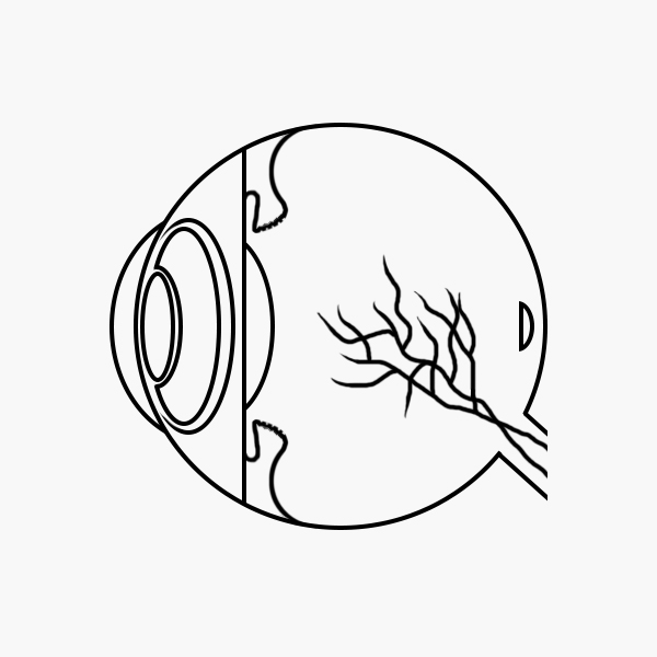 E3I Eye