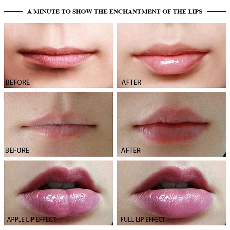 Private label electric silicone beauty lip device lip plumper full lip enhancement pump