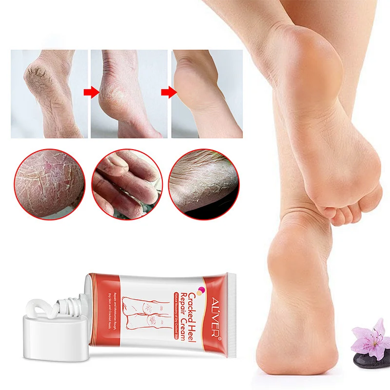 Foot care repairs and Moisturrize rough and dry skin cracked heel repair cream
