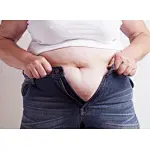 An innovation weight loss technology --- low level laser/light therapy (LLLT)