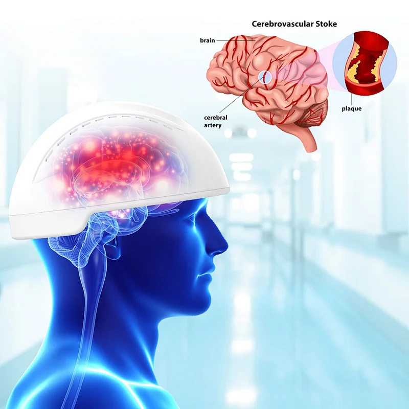 Transcranial pbm near infrared brain treatment helmet brain photobiomodulation machine