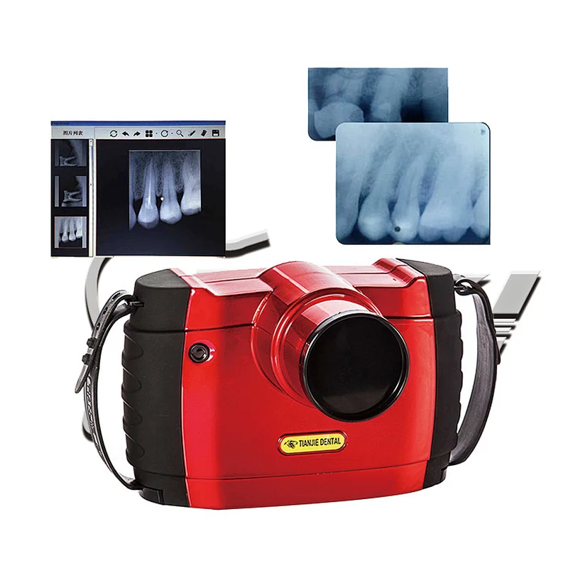 Portable usage control microprocessor control dental sensor digital dental x-ray