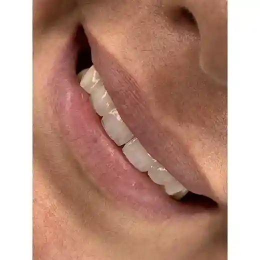 dental zirconia disc