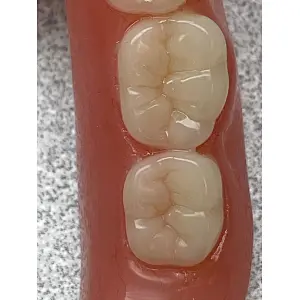 Vsmile PMMA Disc Blank for Open CADCAM System Make Temporary Bridge Dental Restorations for dental lab