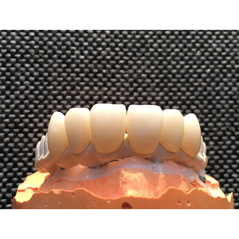 Vsmile CADCAM PEEK Blank for Partial Denture