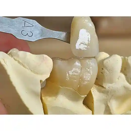 a1/a2/a3 color dental zirconia block
