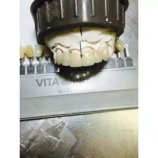 st zirconia