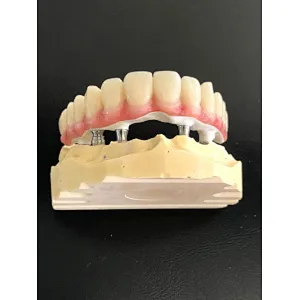 Vsmile CADCAM PEEK Blank for Partial Denture