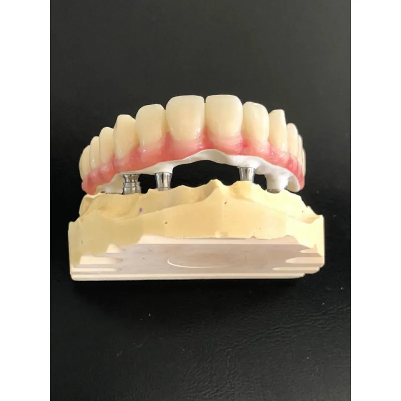 Vsmile CADCAM PEEK Blank for Partial Denture