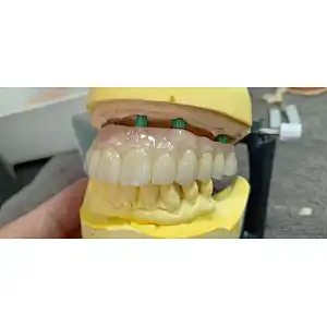 HappyZir 98mm/95mm/71mm ST Super Translucency Pre-shaded Zirconia Disc