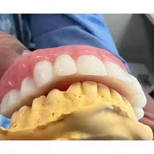 Full Denture PMMA Block