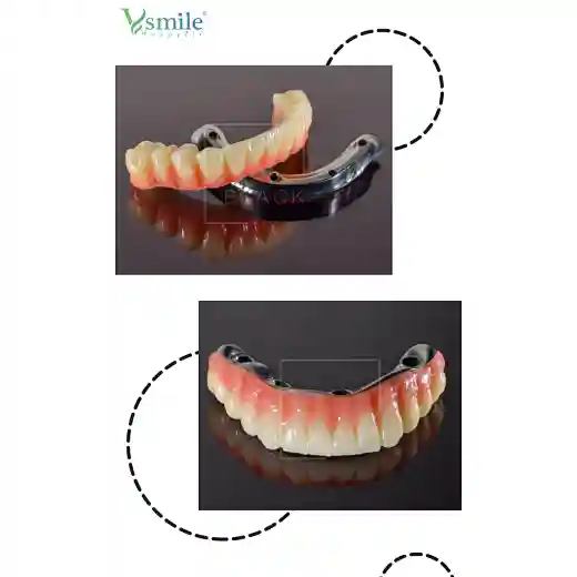 Dental titanium disc