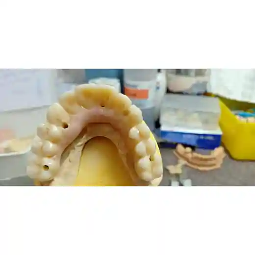 full arch
