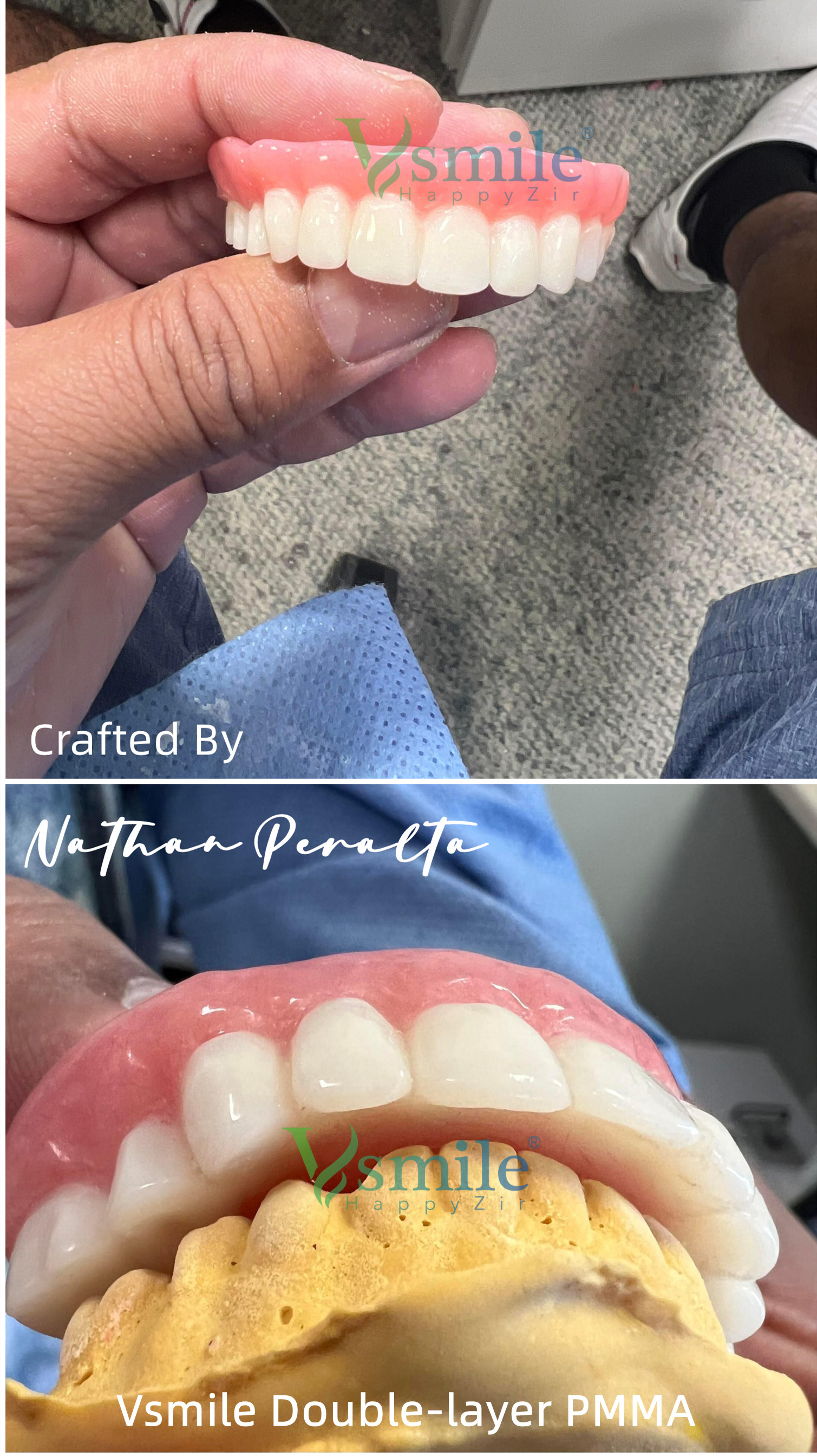 Full Denture Double Layer PMMA