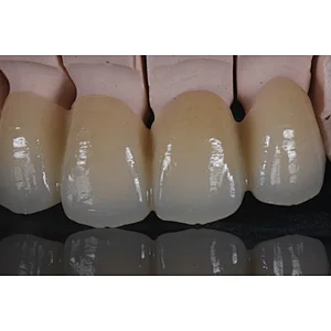 Happyzir UT Multilayer zirconia disc ultra translucent high aesthetic restoration for anterior teeth dental lab