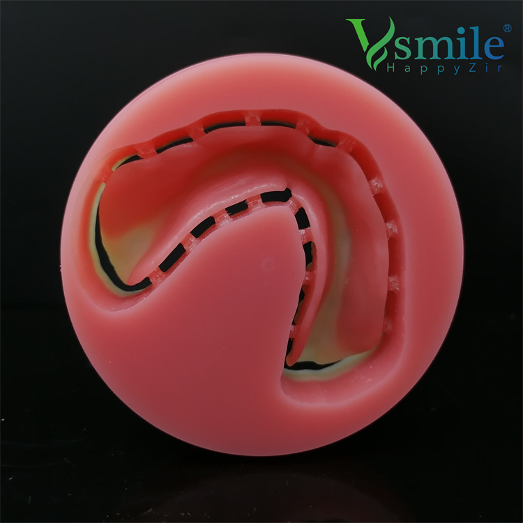 Full Denture Double Layer PMMA