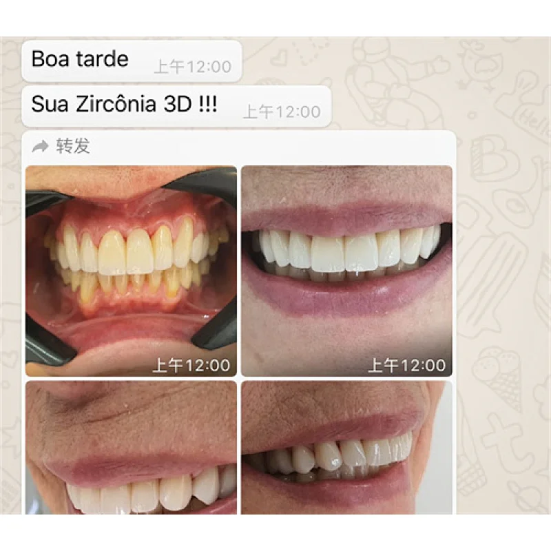 Vsmile 95mm Dental Zirconia Block 3D Pro Multilayer