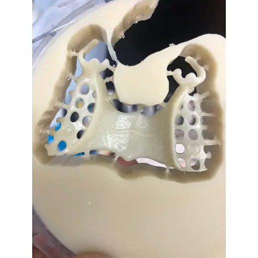 equipment for dental prosthesis