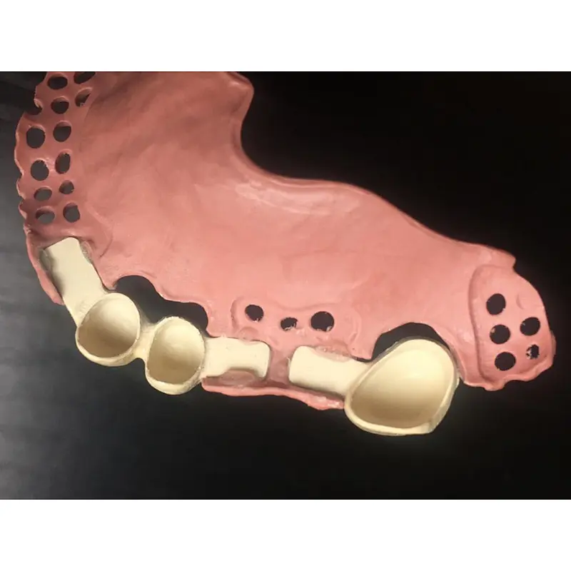 Vsmile 95mm PEEK disc for dental  partial denture compatible with Zirkonzahn CADCAM System