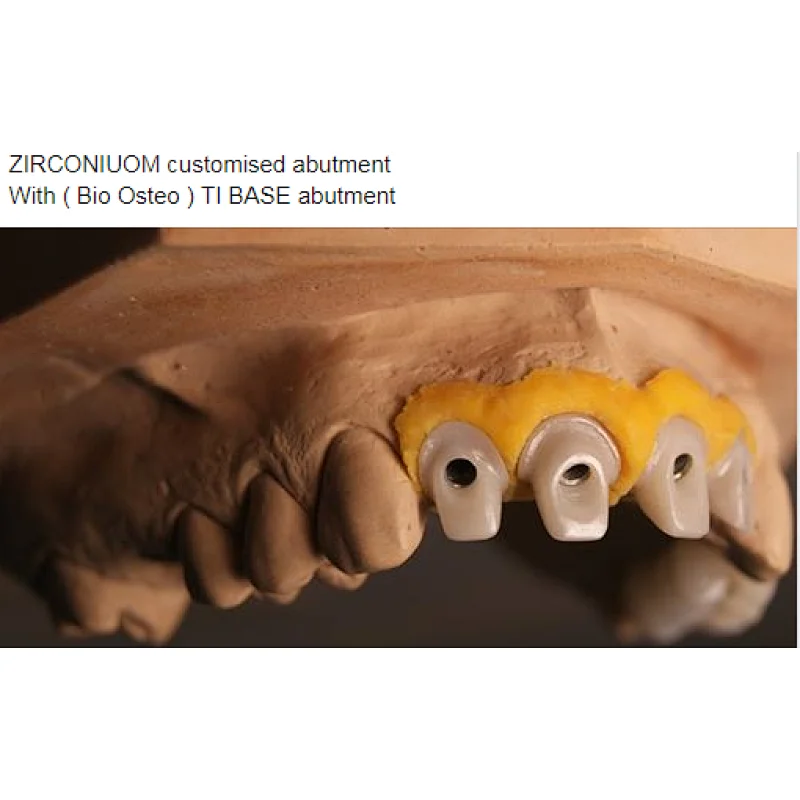 Vsmile D-shape Amann Girrbach dental Materials  HT Zirconia white Blank