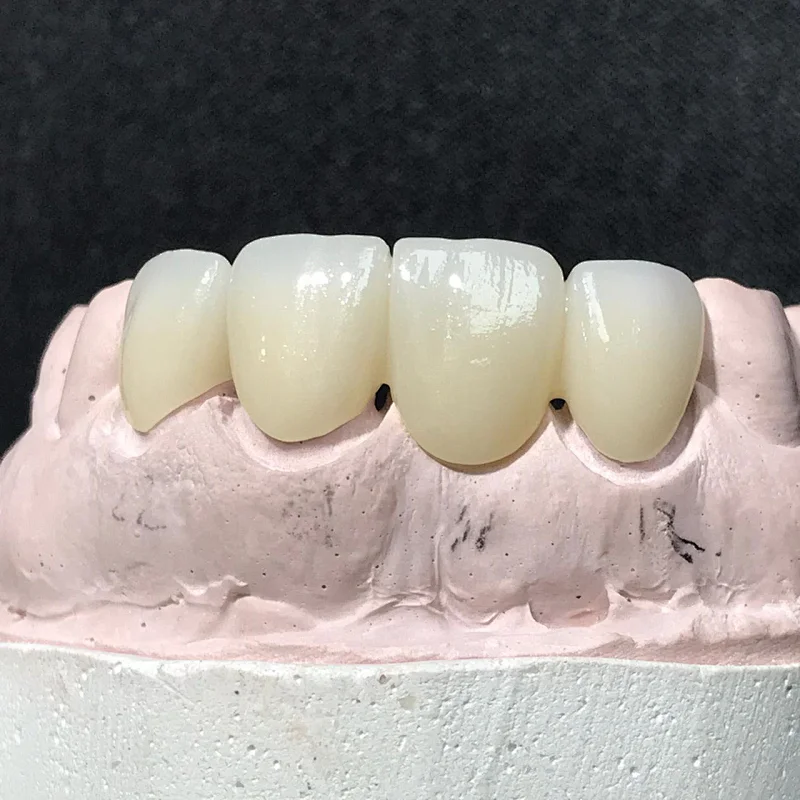 Vsmile 95mm UT Preshaded Ultra Translucency 49% Dental Zirconia Disc
