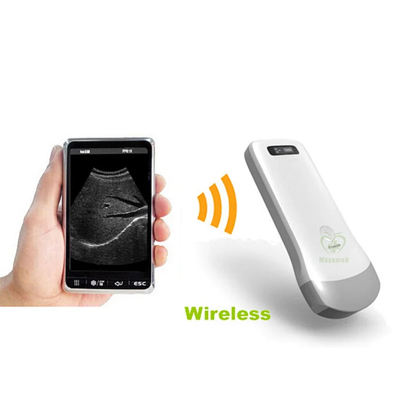 MY-A010B work on android/ios system portable wireless ultrasonic probe (80 elements) type ultrasound scanner
