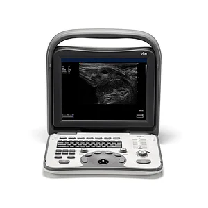 128 elements portable ultrasound scanner,medical ultrasound instruments