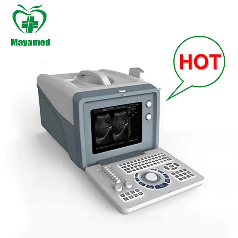 MY-A001A Medical Ultra Sound Machine 10 inch VGA monitor b ultrasound scanner portable ultrasound machine from China