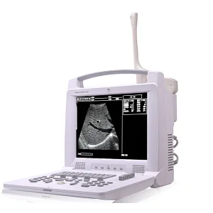 Digital portable ultrasound scanner medical equipment cavitation ultrasouns trolly  machine price cheapest screen echography