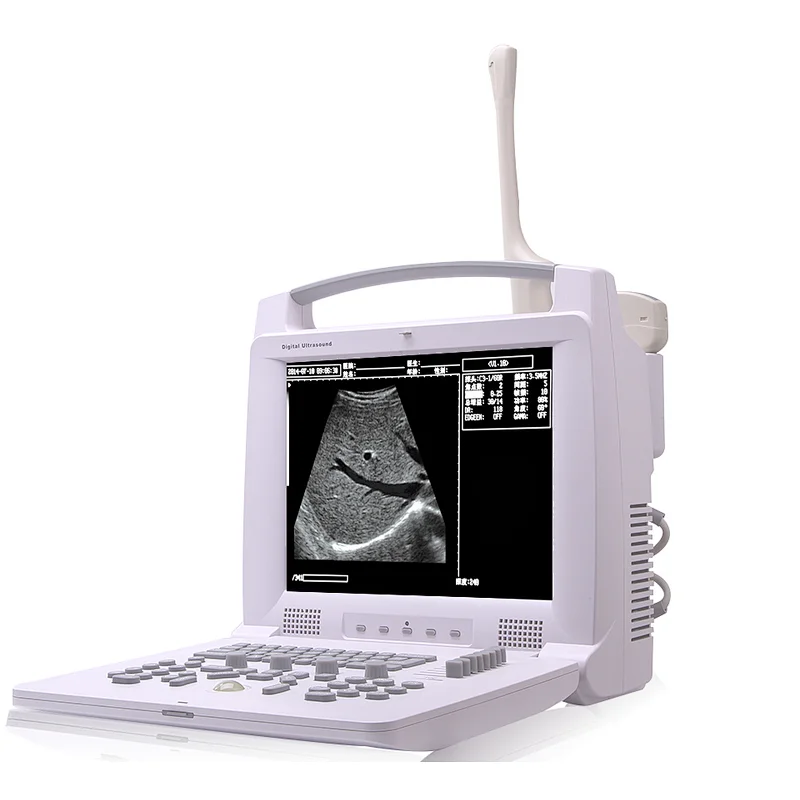 Digital portable ultrasound scanner medical equipment cavitation ultrasouns trolly  machine price cheapest screen echography