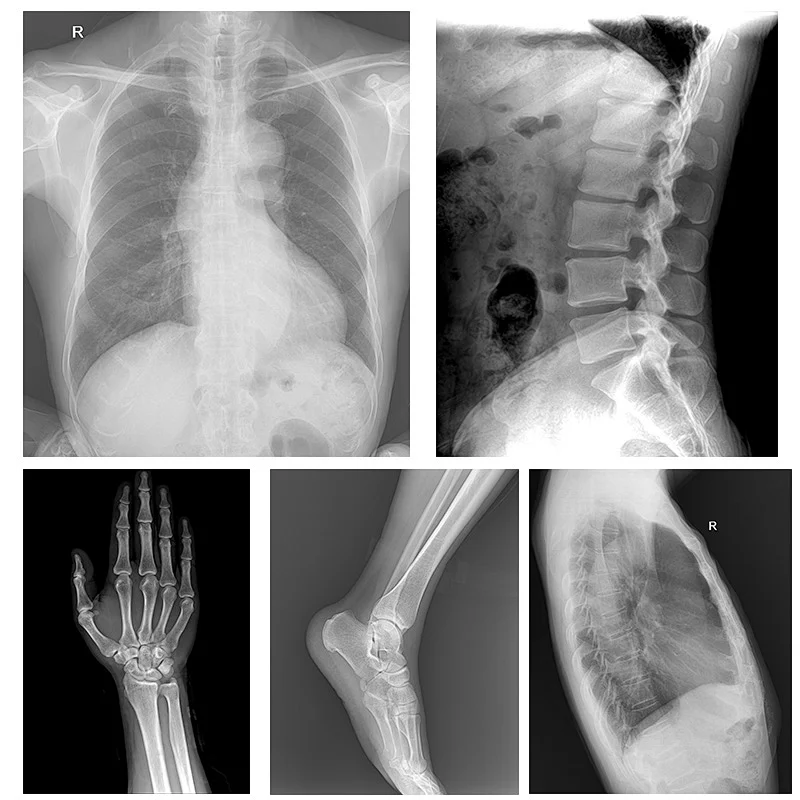 MY-D049J High frequency xray machines medical digital x-ray radiography system