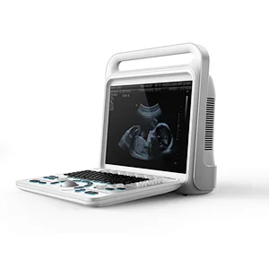 6 in 1 Cavitation ultrasound trolly machine cheapest echography wireless led color doppler ultrasound diagnosing dppler scanner