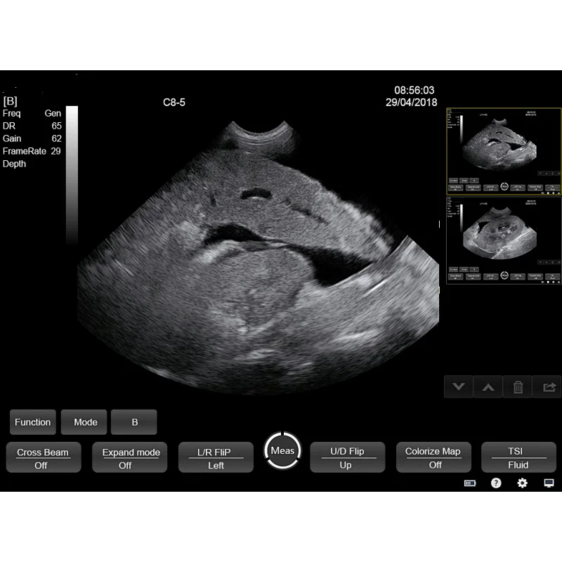 MY-A012-N Vet touch B/W portable ultrasound dcanner system animal ultrasound machine