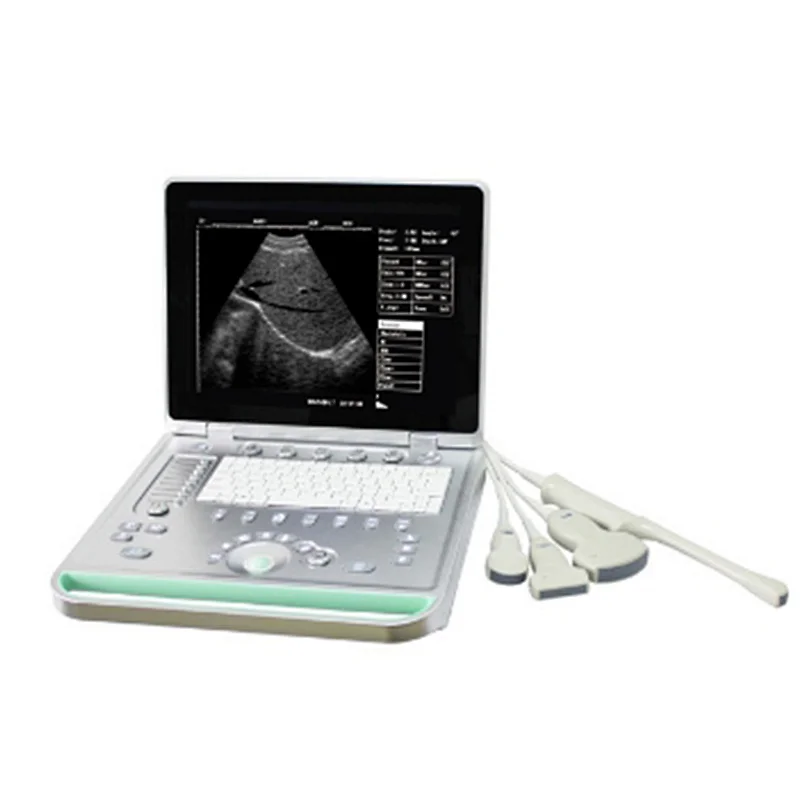 High quality echocardiography diagnostic machine Portable Laptop Ultrasound Scanner with Probe
