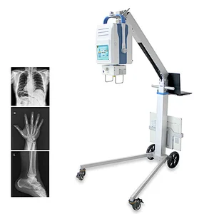MY-D049R medical hospital instrument mobile x-ray scanner digital portable x ray equipment price