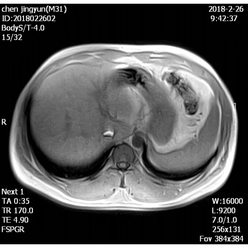 MY-D054 Hospital Medical 0.5T MRI scanner/scan/machine equipment price for sale